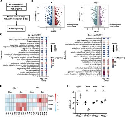 Delayed denervation-induced muscle atrophy in Opg knockout mice